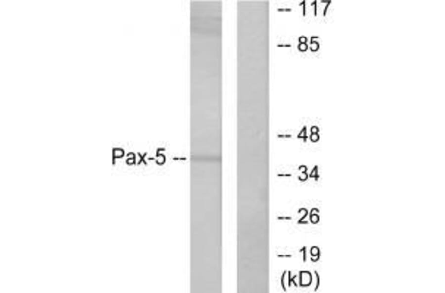 Western blot - Pax-5 Antibody from Signalway Antibody (33467) - Antibodies.com