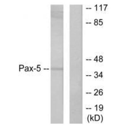 Western blot - Pax-5 Antibody from Signalway Antibody (33467) - Antibodies.com