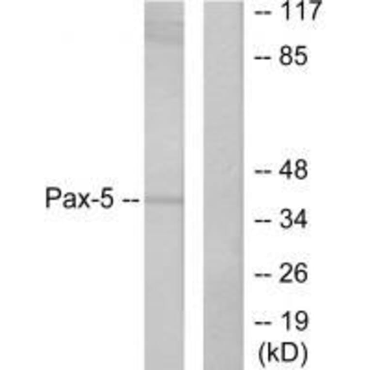 Western blot - Pax-5 Antibody from Signalway Antibody (33467) - Antibodies.com
