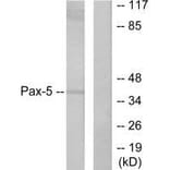 Western blot - Pax-5 Antibody from Signalway Antibody (33467) - Antibodies.com