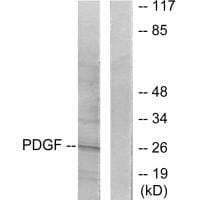 Western blot analysis of extracts from NIH/3T3 cells, using PDGFB antibody #33469.