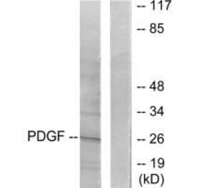 Western blot - PDGFB Antibody from Signalway Antibody (33469) - Antibodies.com