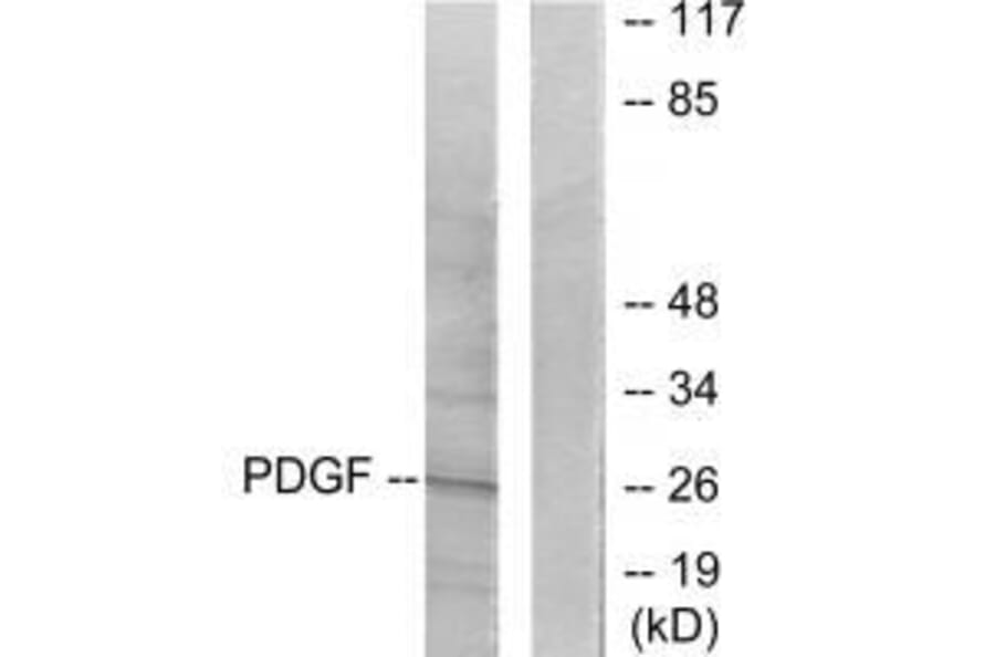 Western blot - PDGFB Antibody from Signalway Antibody (33469) - Antibodies.com