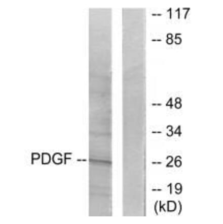 Western blot - PDGFB Antibody from Signalway Antibody (33469) - Antibodies.com