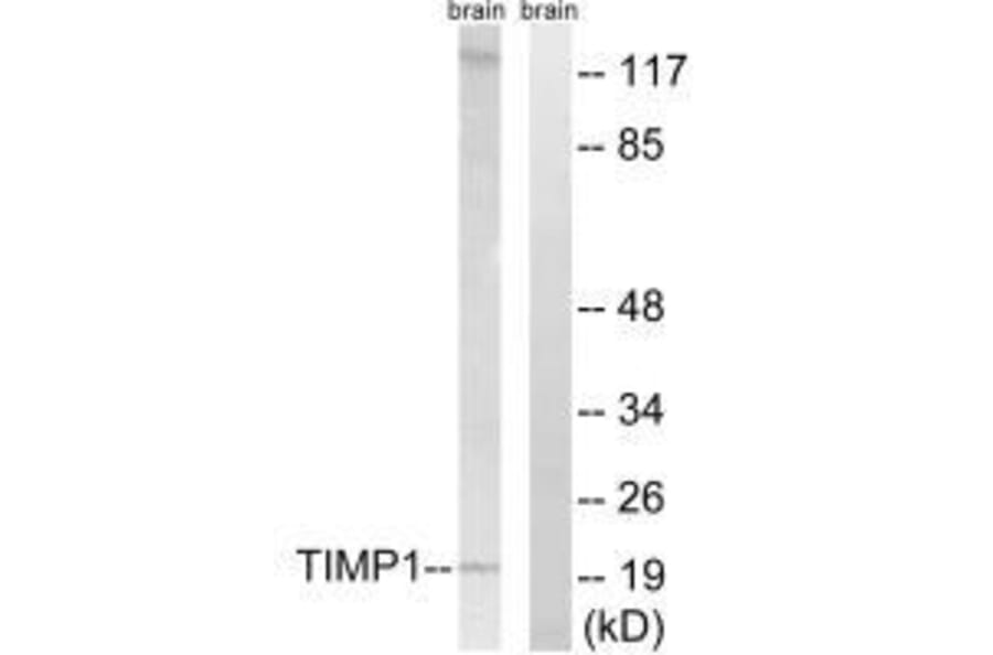 Western blot - TIMP1 Antibody from Signalway Antibody (33502) - Antibodies.com