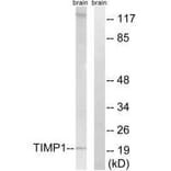 Western blot - TIMP1 Antibody from Signalway Antibody (33502) - Antibodies.com