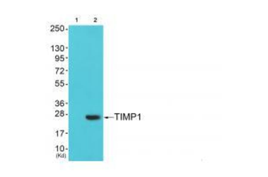Western blot - TIMP1 Antibody from Signalway Antibody (33502) - Antibodies.com