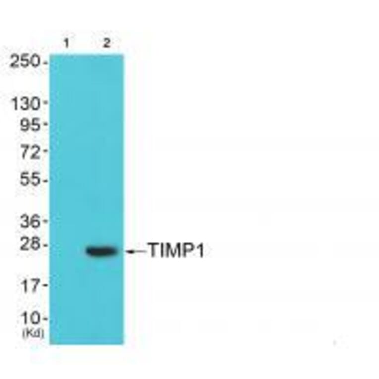 Western blot - TIMP1 Antibody from Signalway Antibody (33502) - Antibodies.com