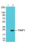 Western blot - TIMP1 Antibody from Signalway Antibody (33502) - Antibodies.com