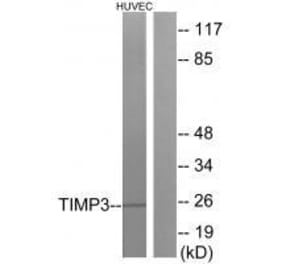 Western blot - TIMP3 Antibody from Signalway Antibody (33504) - Antibodies.com