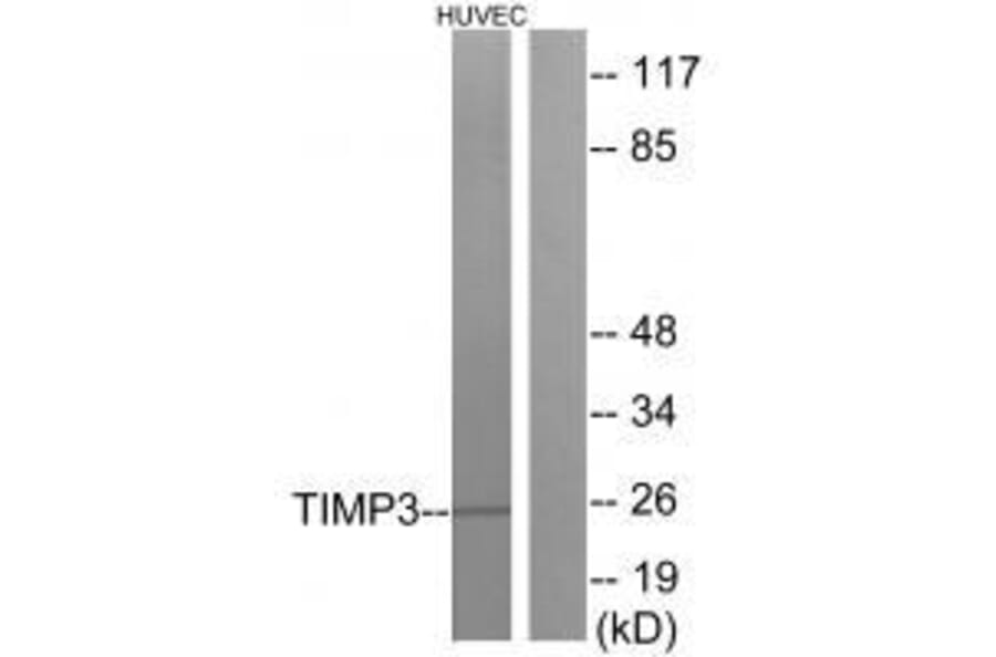 Western blot - TIMP3 Antibody from Signalway Antibody (33504) - Antibodies.com