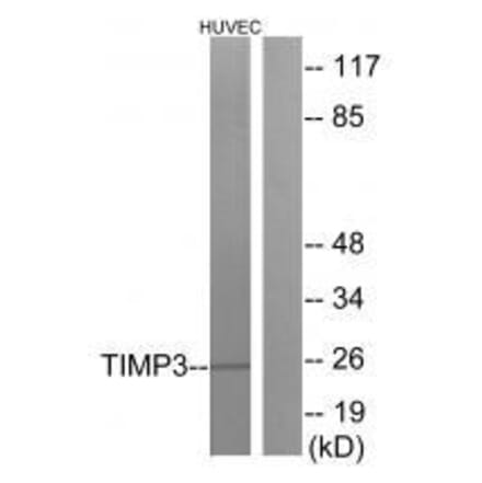 Western blot - TIMP3 Antibody from Signalway Antibody (33504) - Antibodies.com