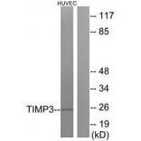 Western blot - TIMP3 Antibody from Signalway Antibody (33504) - Antibodies.com