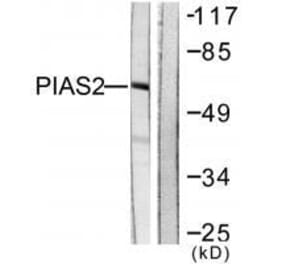 Western blot - PIAS2 Antibody from Signalway Antibody (33516) - Antibodies.com