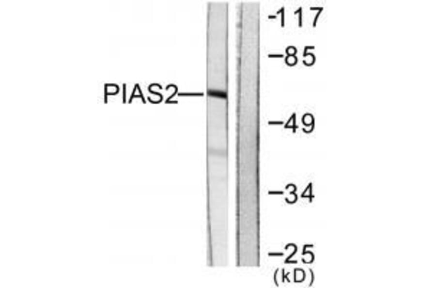 Western blot - PIAS2 Antibody from Signalway Antibody (33516) - Antibodies.com