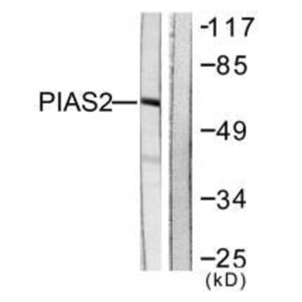 Western blot - PIAS2 Antibody from Signalway Antibody (33516) - Antibodies.com