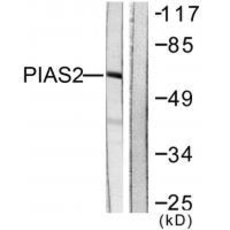 Western blot - PIAS2 Antibody from Signalway Antibody (33516) - Antibodies.com