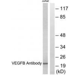 Western blot - VEGFB Antibody from Signalway Antibody (33540) - Antibodies.com