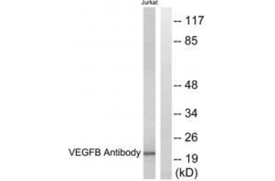 Western blot - VEGFB Antibody from Signalway Antibody (33540) - Antibodies.com