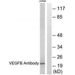 Western blot - VEGFB Antibody from Signalway Antibody (33540) - Antibodies.com