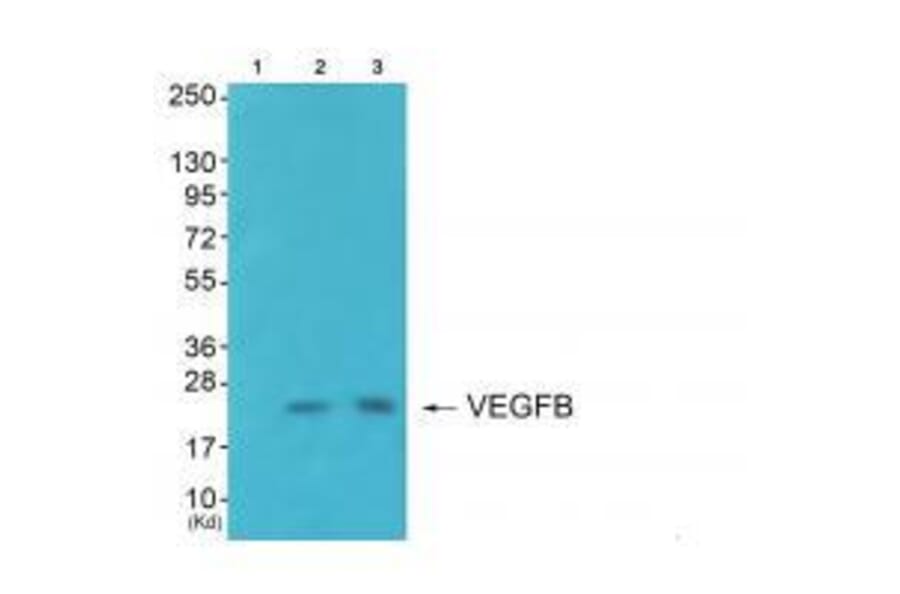 Western blot - VEGFB Antibody from Signalway Antibody (33540) - Antibodies.com