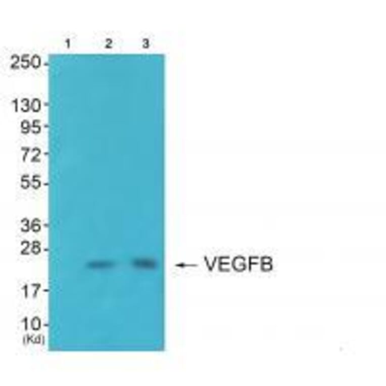 Western blot - VEGFB Antibody from Signalway Antibody (33540) - Antibodies.com