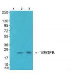 Western blot - VEGFB Antibody from Signalway Antibody (33540) - Antibodies.com