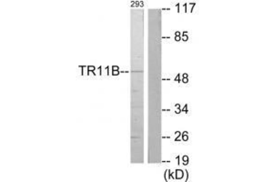Western blot - TR11B Antibody from Signalway Antibody (33557) - Antibodies.com