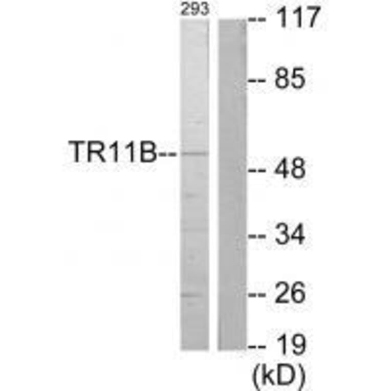 Western blot - TR11B Antibody from Signalway Antibody (33557) - Antibodies.com