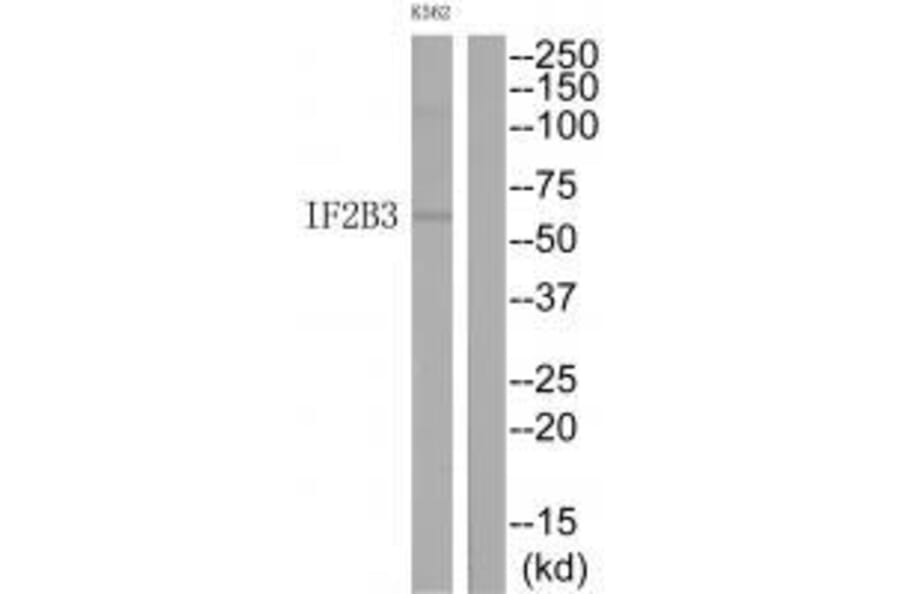 Western blot - IF2B3 Antibody from Signalway Antibody (33560) - Antibodies.com