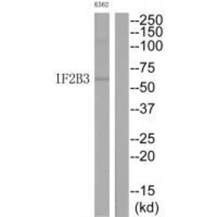 Western blot - IF2B3 Antibody from Signalway Antibody (33560) - Antibodies.com