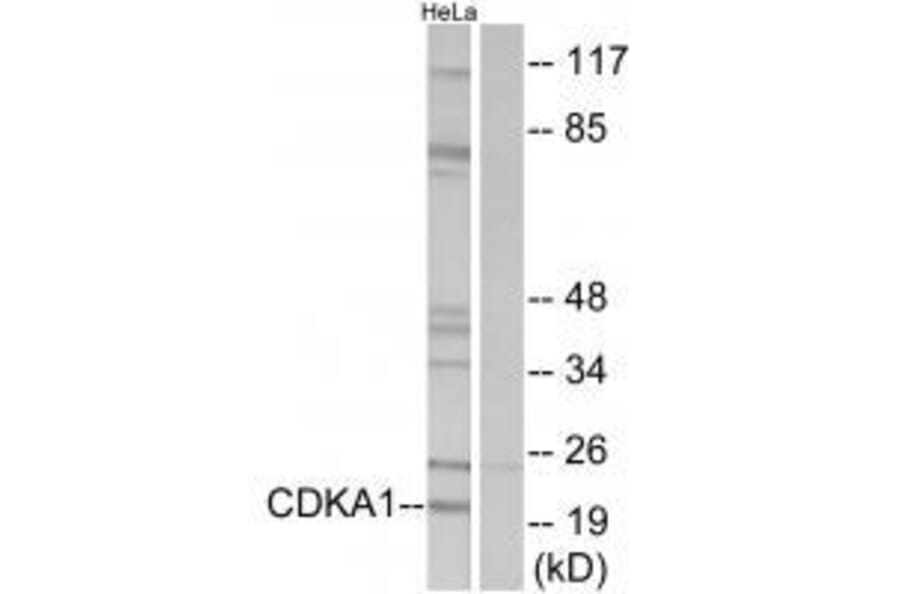 Western blot - CDKA1 Antibody from Signalway Antibody (33564) - Antibodies.com