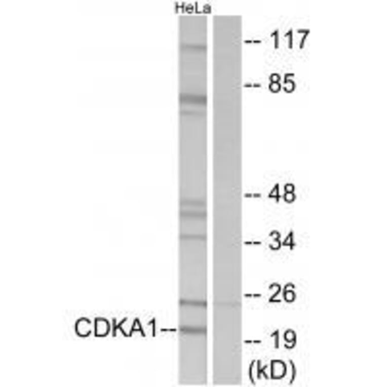 Western blot - CDKA1 Antibody from Signalway Antibody (33564) - Antibodies.com