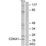 Western blot - CDKA1 Antibody from Signalway Antibody (33564) - Antibodies.com