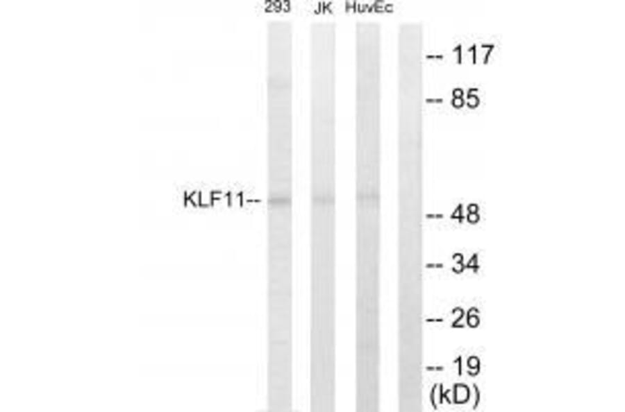 Western blot - KLF11 Antibody from Signalway Antibody (33571) - Antibodies.com