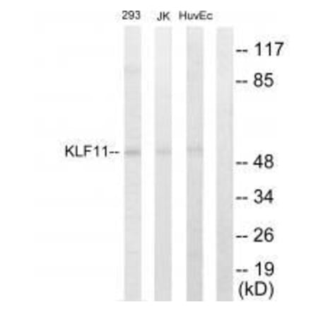 Western blot - KLF11 Antibody from Signalway Antibody (33571) - Antibodies.com