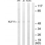 Western blot - KLF11 Antibody from Signalway Antibody (33571) - Antibodies.com