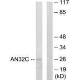 Western blot - AN32C Antibody from Signalway Antibody (33583) - Antibodies.com