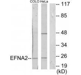 Western blot - EFNA2 Antibody from Signalway Antibody (33591) - Antibodies.com
