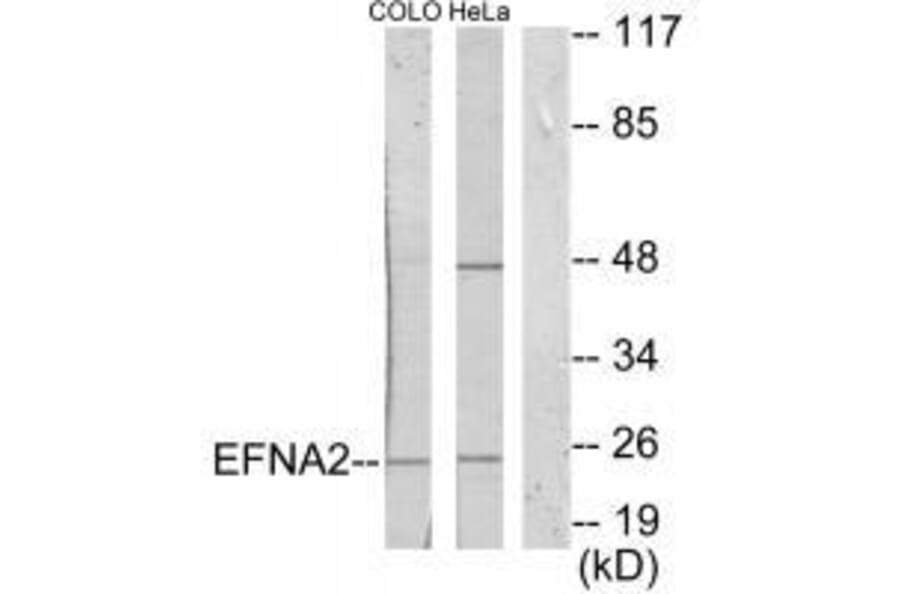 Western blot - EFNA2 Antibody from Signalway Antibody (33591) - Antibodies.com