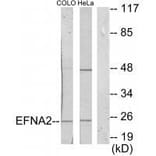 Western blot - EFNA2 Antibody from Signalway Antibody (33591) - Antibodies.com