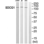 Western blot - SDCG1 Antibody from Signalway Antibody (33600) - Antibodies.com