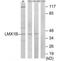 Western blot analysis of extracts from Jurkat cells, 293 cells and HUVEC cells, using LMX1B antibody #33601.
