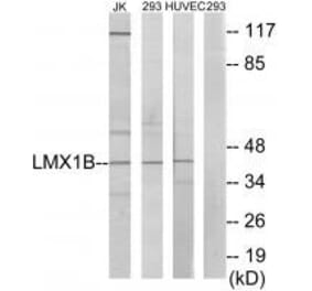 Western blot - LMX1B Antibody from Signalway Antibody (33601) - Antibodies.com
