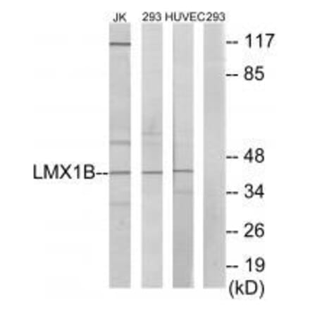 Western blot - LMX1B Antibody from Signalway Antibody (33601) - Antibodies.com