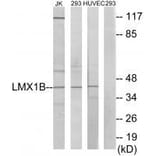 Western blot - LMX1B Antibody from Signalway Antibody (33601) - Antibodies.com
