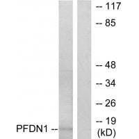 Western blot analysis of extracts from RAW264.7 cells, using PFDN1 antibody #33606.