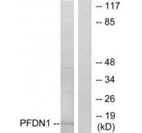 Western blot - PFDN1 Antibody from Signalway Antibody (33606) - Antibodies.com