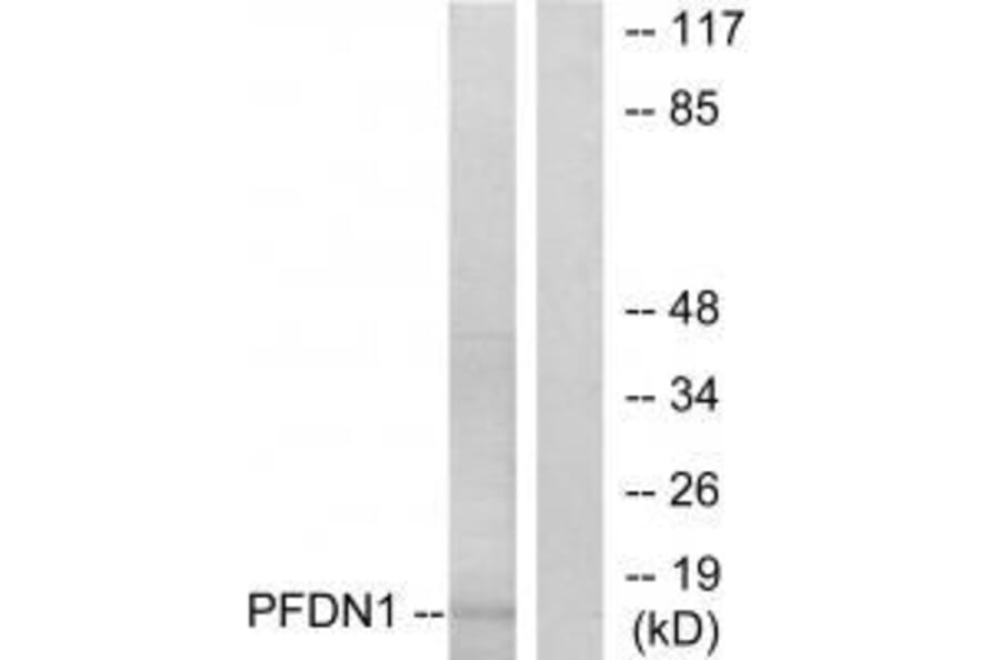 Western blot - PFDN1 Antibody from Signalway Antibody (33606) - Antibodies.com