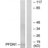 Western blot - PFDN1 Antibody from Signalway Antibody (33606) - Antibodies.com